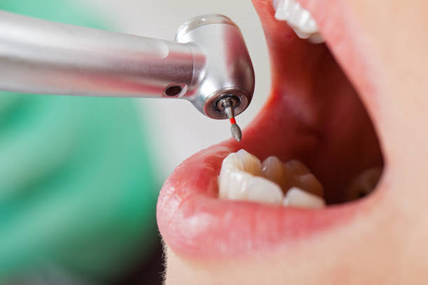 Best Emergency Denture Repair in Cortland, OH